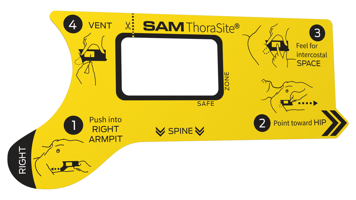 SAM ThoraSite